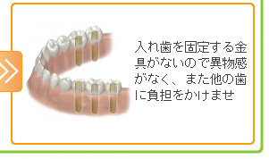 入れ歯を固定する金具がないので異物感がなく、また他の歯に負担をかけません。