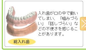 入れ歯が口の中で動いてしまい、「噛みづらい」「話しづらい」などの不便さを感じることがあります。